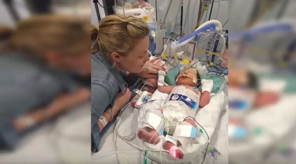 Bebê nascido prematuro é declarado morto e passa 8 minutos e médicos testemunham milagre quando o bebê revive