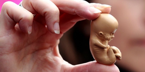Ativista pró-vida segura um modelo de embrião durante protesto em Belfast. (Foto: Cathal Mcnaughton/Reuters)